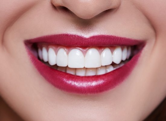 Closeup of smile after crown lengthening