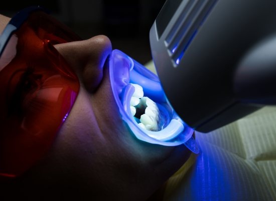 Patient receiving professional teeth whitening