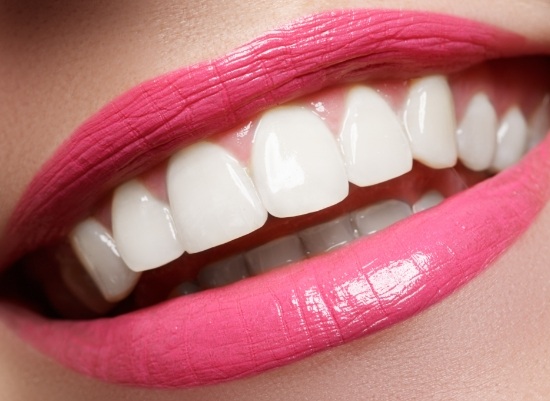 Closeup of smile after gum recontouring