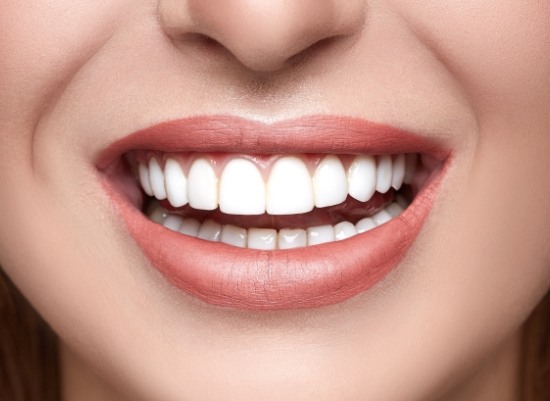 Closeup of flawless smile after crown lengthening