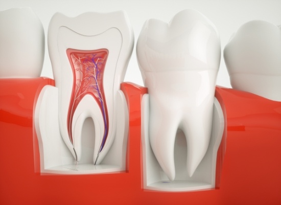 Animated smile in need of endodontic treatment