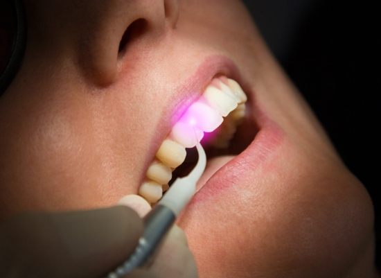 Patient receiving soft tissue laser dentistry treatment