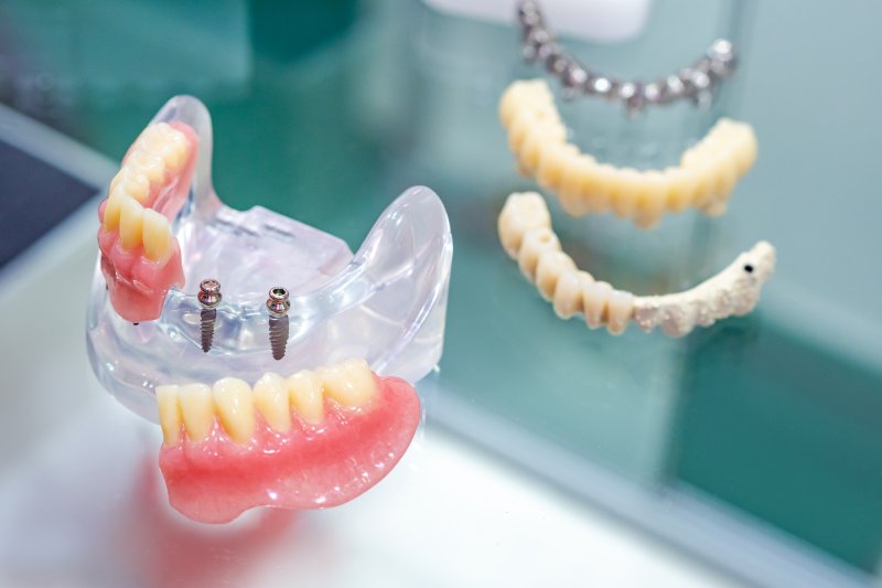 closeup of mini dental implants in Houston