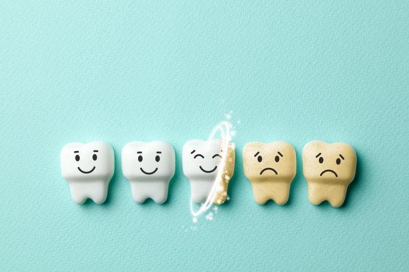 cartoon of a series of teeth getting whiter